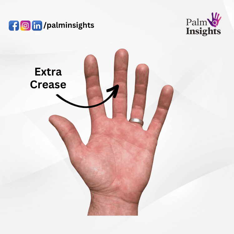 Palmistry image of middle finger with extra horizontal crease creating fourth section, indicating planning challenges.
