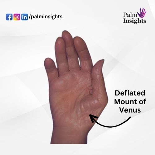 Photo of a hand with a deflated mount of Venus showing a sunken area beneath the thumb, hinting reduced vitality.