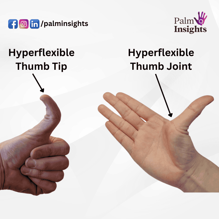 Palmistry illustration featuring two separate thumb types: a hitchhiker's thumb with a flexible tip and a hand with a hypermobile thumb joint.