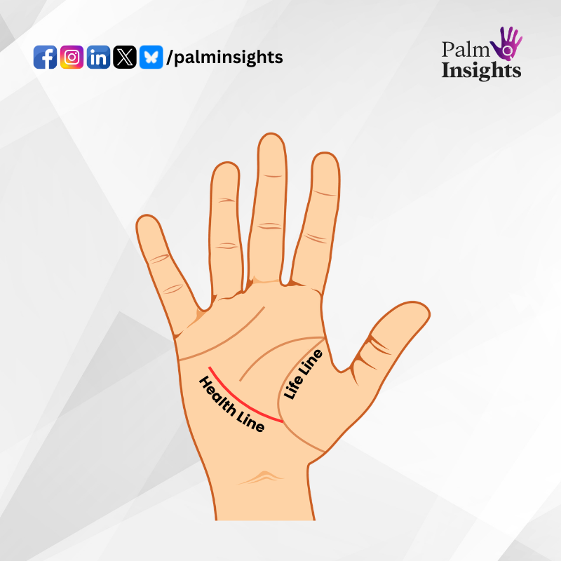 Illustration of palm with health line starting from the life line, explaining meaning of this intersection in palmistry.