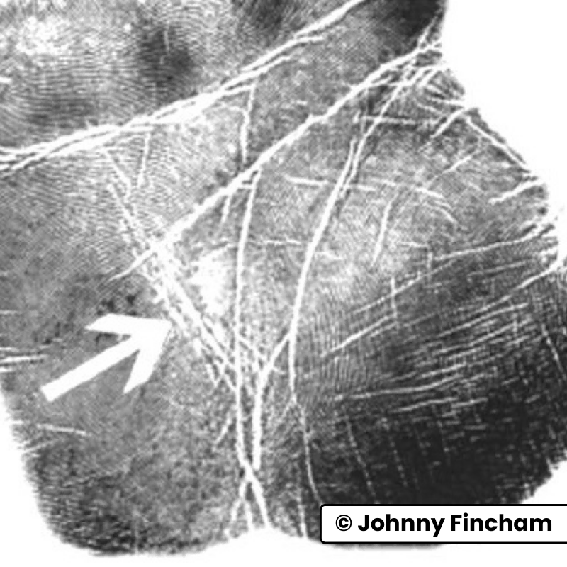 Palm print close‑up with arrow highlighting a fuzzy and fragmented health line, signifying chronic issues in palmistry